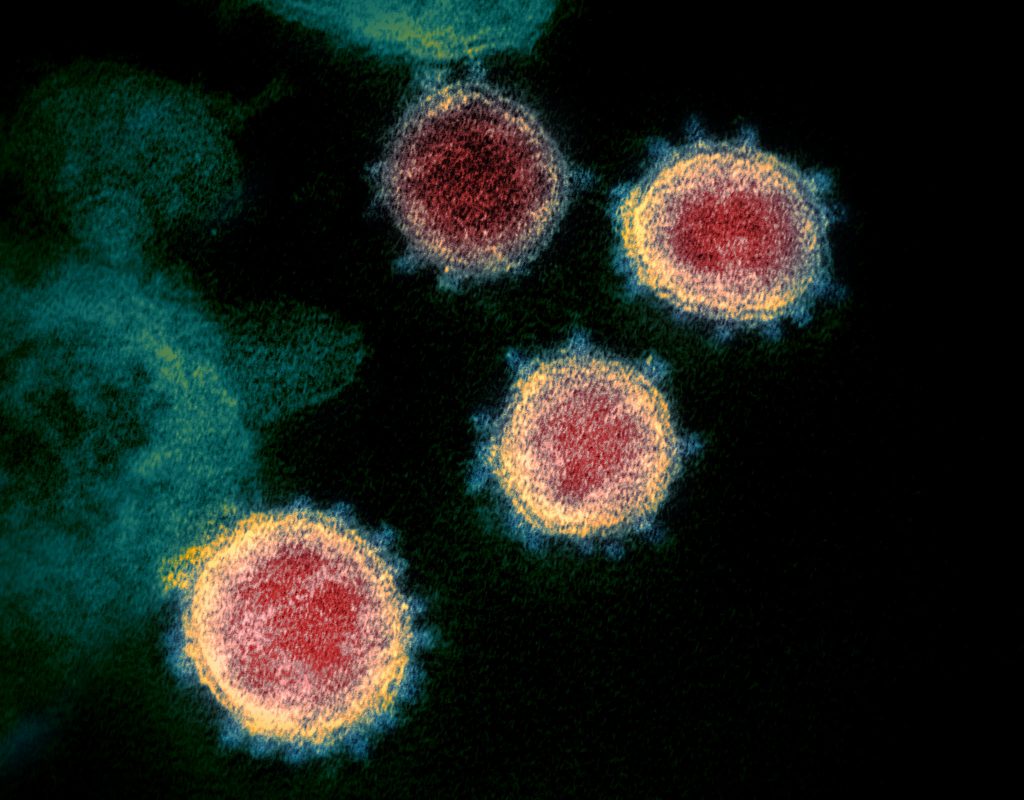 sars-cov-2_coronavirus19-1024x800.jpg