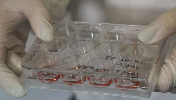 5-petri-dish-with-tissue-samples-credit-sagol-center-for-regenerative-biotechnology-580.jpg
